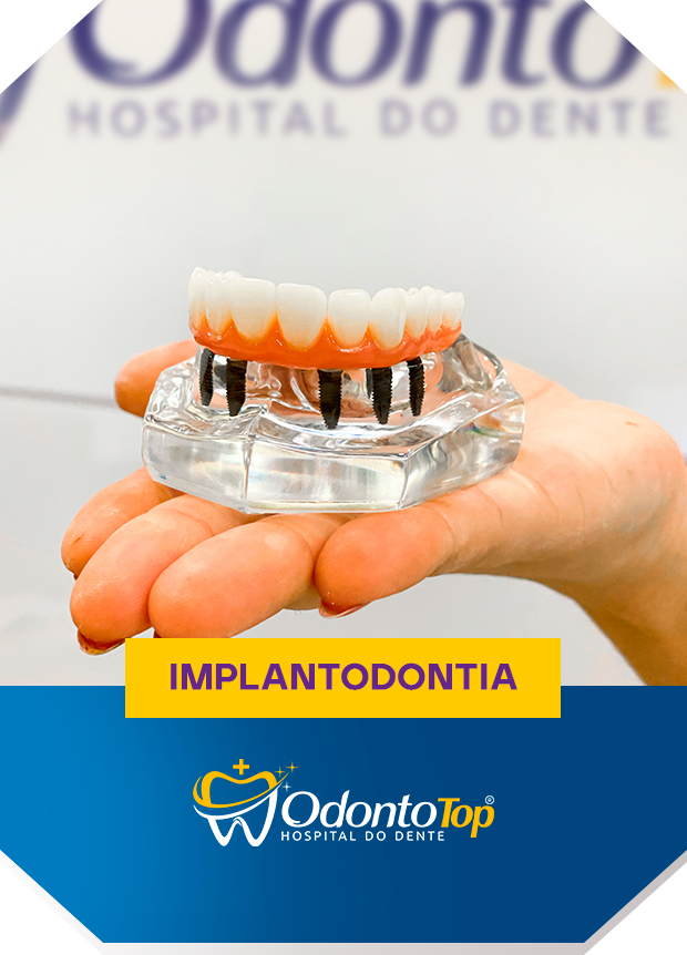 Implantodontia.png