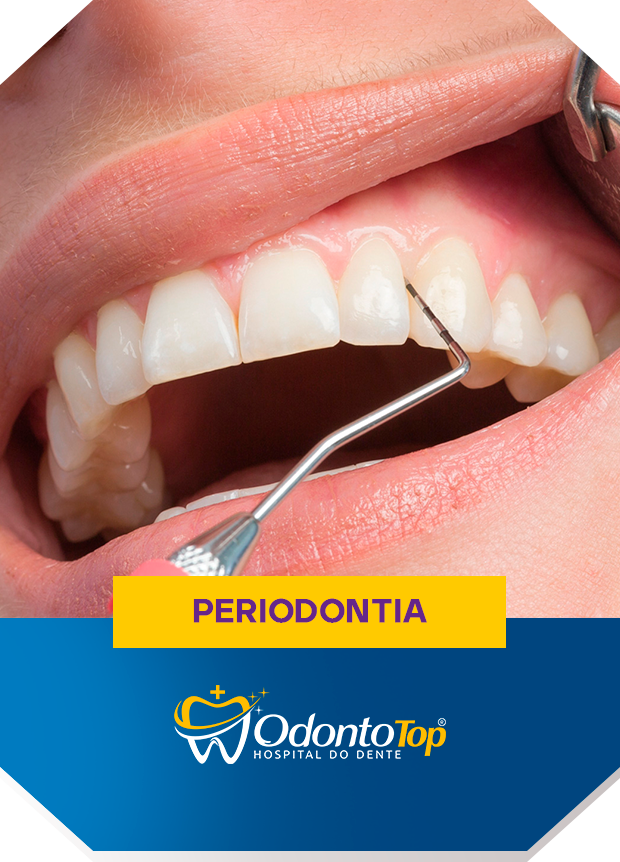 Periodontia.png